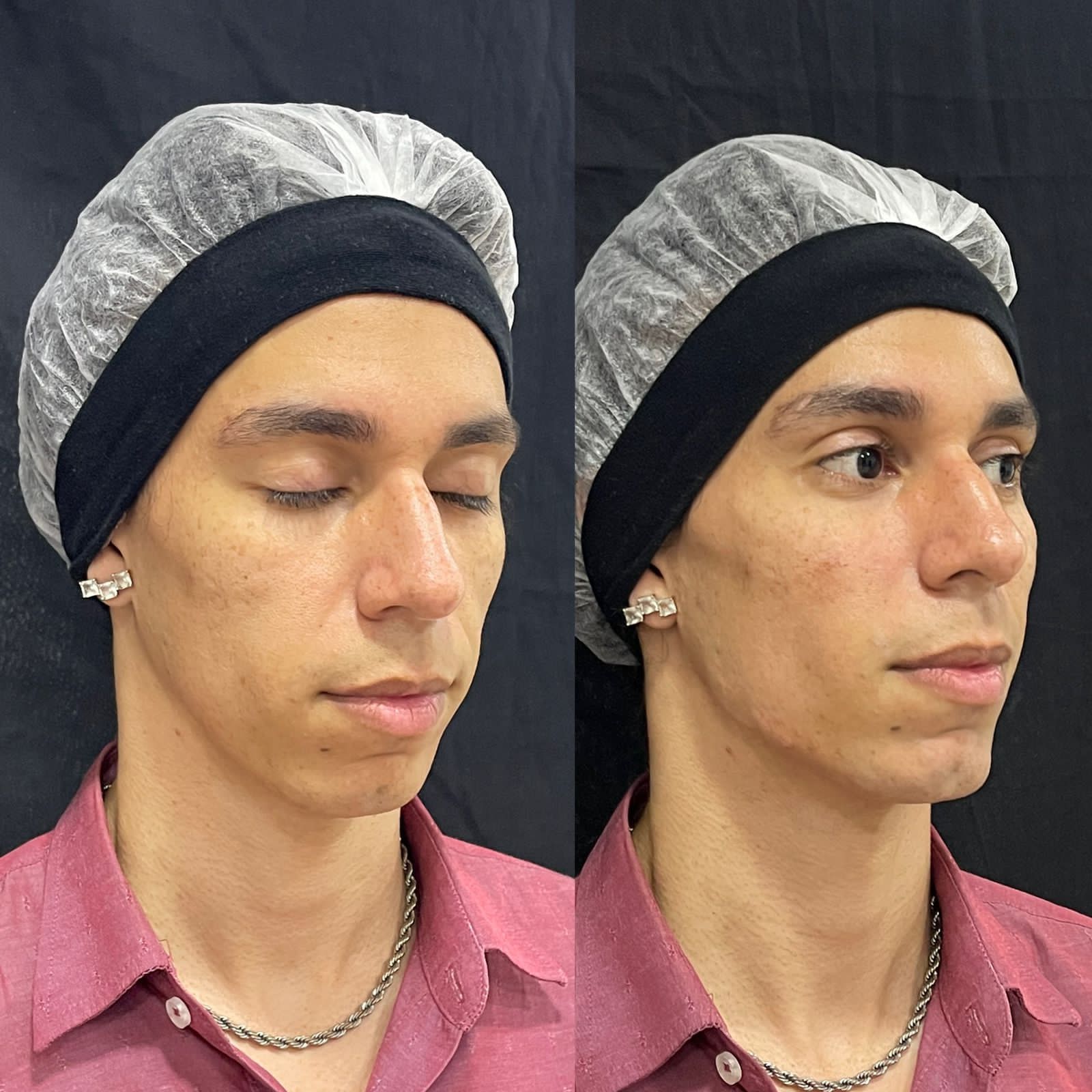 Harmonizacao-Pablo-4.jpg