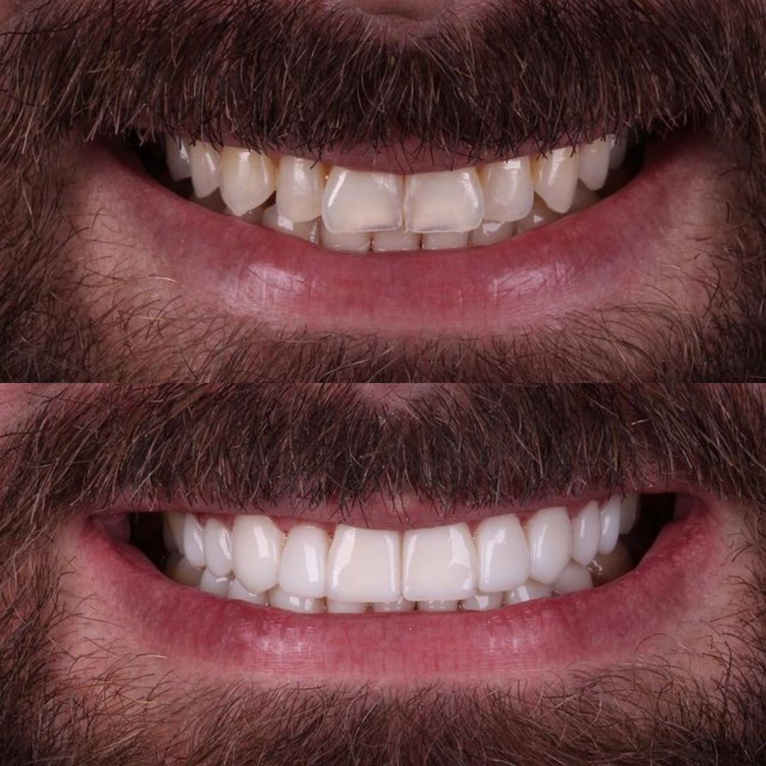 antes-e-depois-2.jpg
