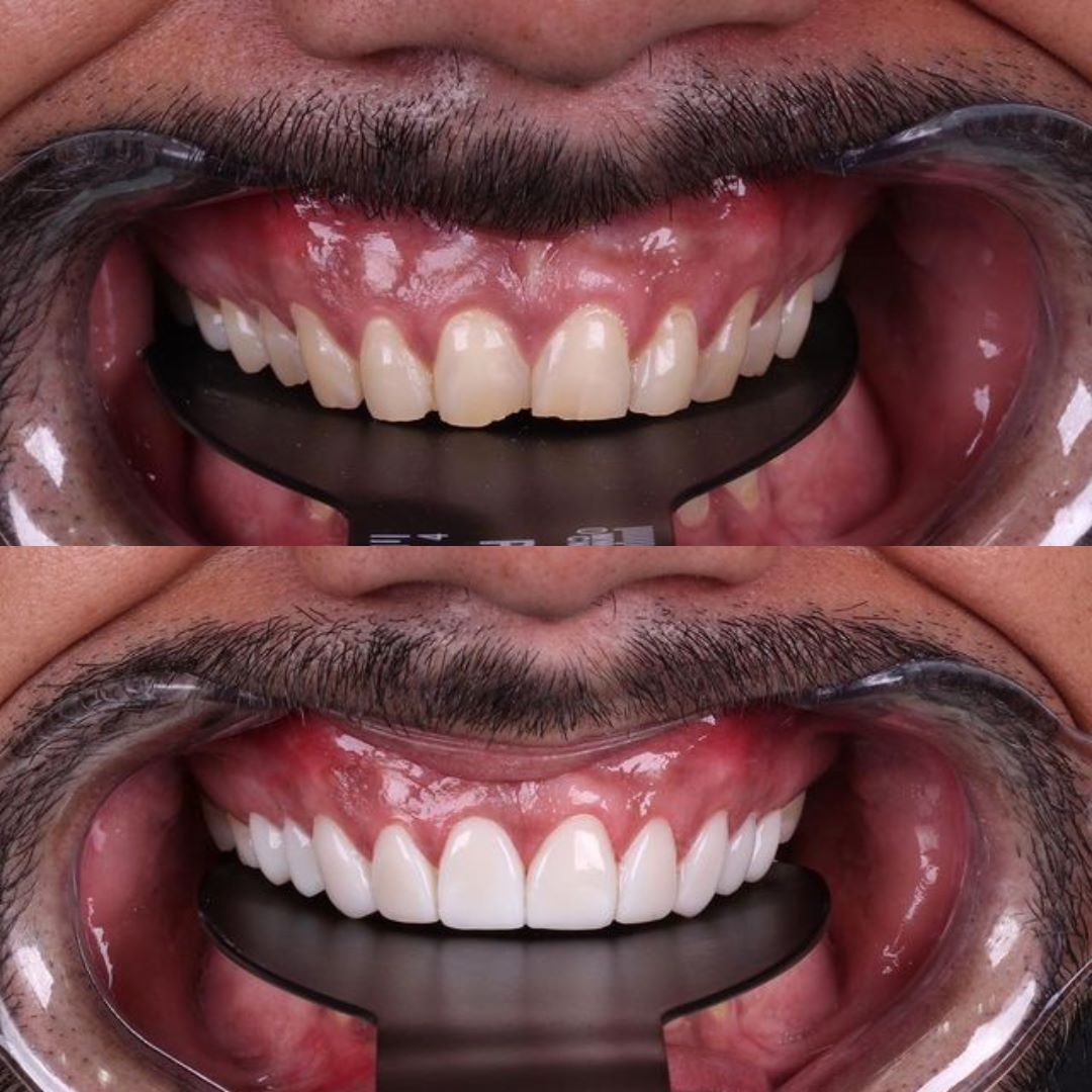 antes-e-depois-4.jpg