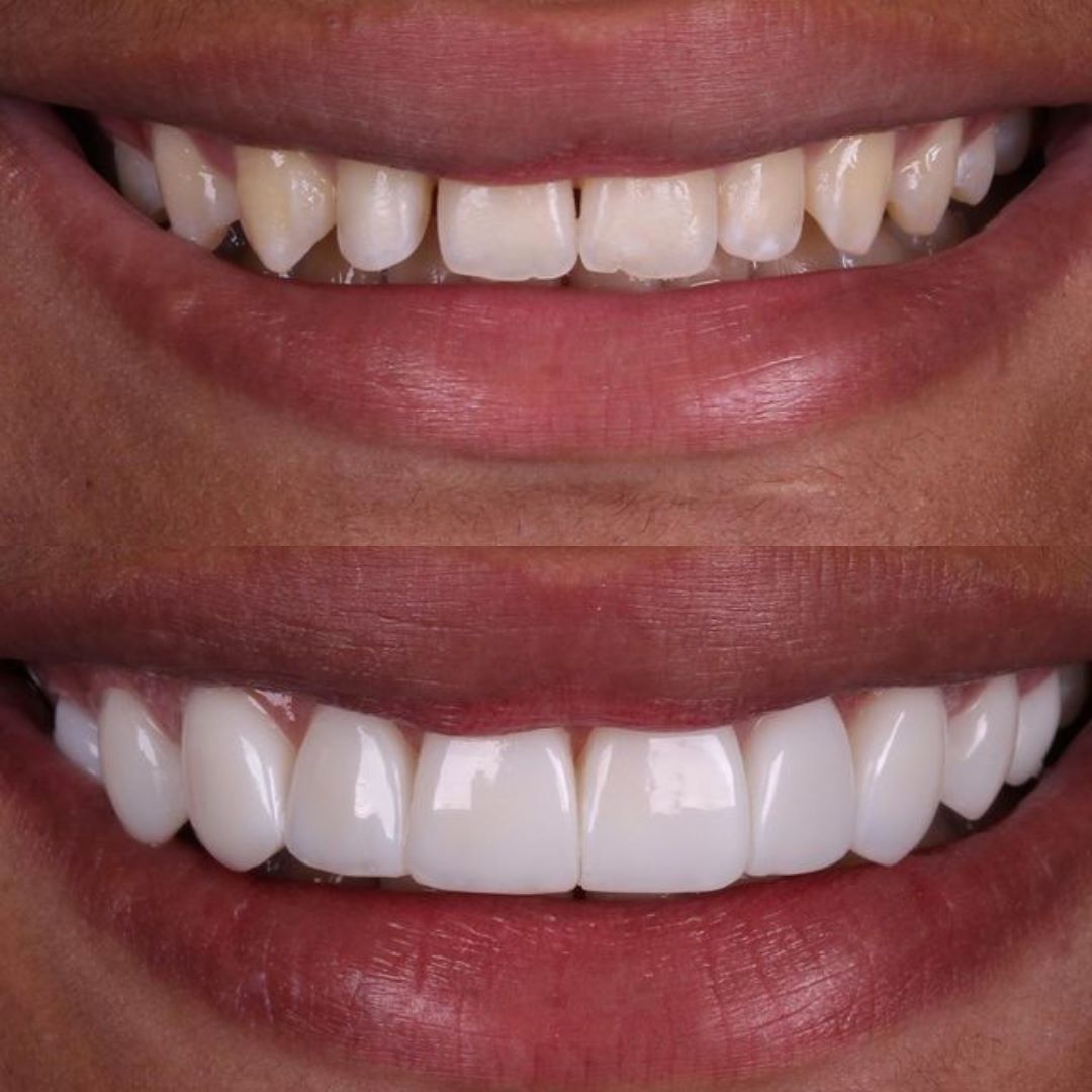antes-e-depois-5.jpg