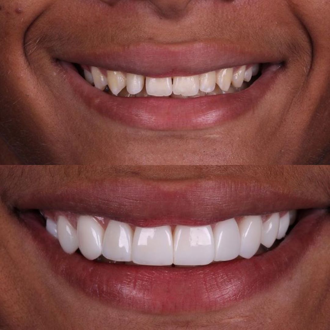 antes-e-depois-7.jpg