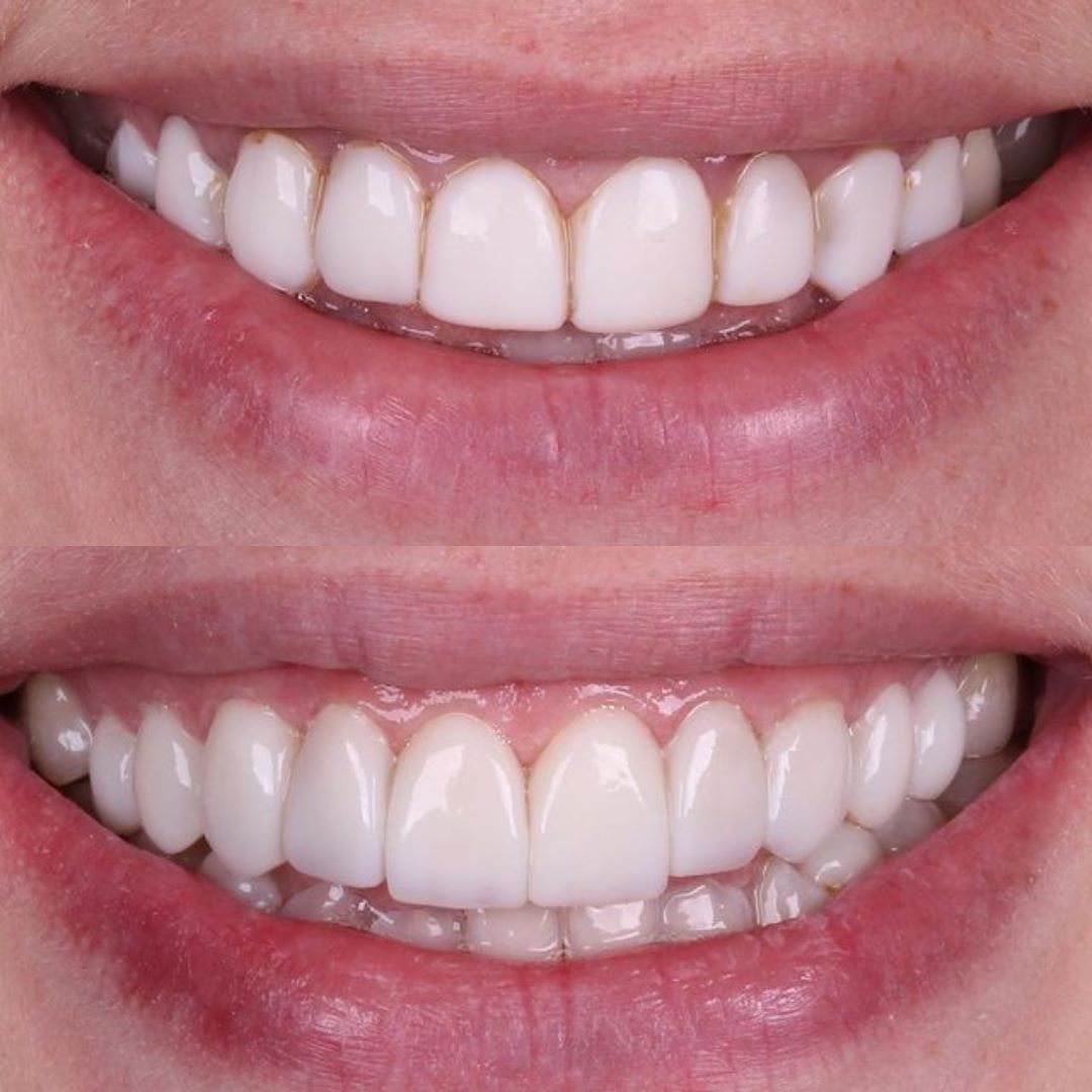 antes-e-depois-8.jpg